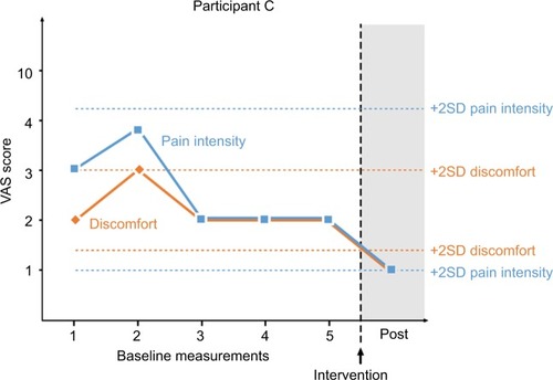 Figure 3 Participant C’s ratings of pain intensity and level of discomfort. Baseline measurements were taken at 50, 35, 20, 5 and 0 minutes prior to intervention.