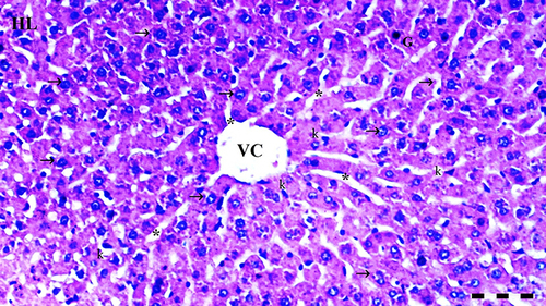 Figure 1 Representative light microscopy of hepatic tissue from the control group. Normal liver tissue. Scale bar 50 µm, H&Ex100.