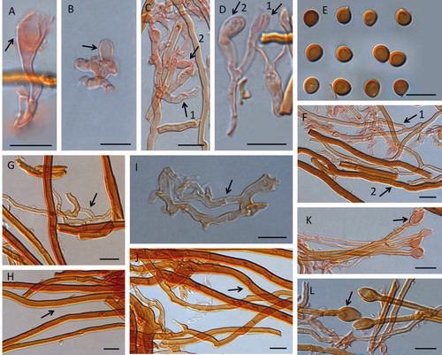 Figure 6. Microscopic structures of Fulvifomes tubogeneratus. Scales bar: 10 μm. A: basidia; B: basidioles; C, D: 1, basidia, 2, basidioles; E: basidiospores; F: 1, tramal generative hyphae, 2, tramal skeletal hyphae; G: generative hyphae from upper context (arrow pointed); H: skeletal hyphae from upper context (arrow pointed); I: generative hyphae from lower context; J: skeletal hyphae from lower context (arrow pointed); K, L: hyphoid setae swollen at apex from tramal.