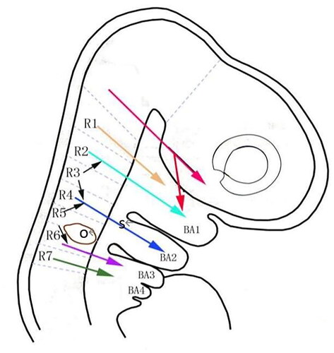 Figure 2. Embryonic development of the ear diagram of segmental migration of neural crest cells. BA1–4: pharyngeal arches 1–4; R1–7: rhombencephalon segments 1–7; O: otic ear sac; S: stapes location.
