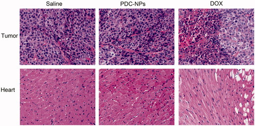 Figure 6. Tumours and hearts sections of mice stained with hematoxylin and eosin (HandE) after treatments with saline, the free DOX, and the PDC-NPs for 14 days.Original magnifications are 200×.