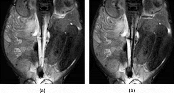 Figure 1. (a) Two selected images from a coronal oblique trueFISP-image series (frame rate 3 images/s) of the Gadomer-17 enhanced abdominal vessels. The images are continuously acquired before (a) and during (b) CO2 injection through a catheter located in the suprarenal aorta.