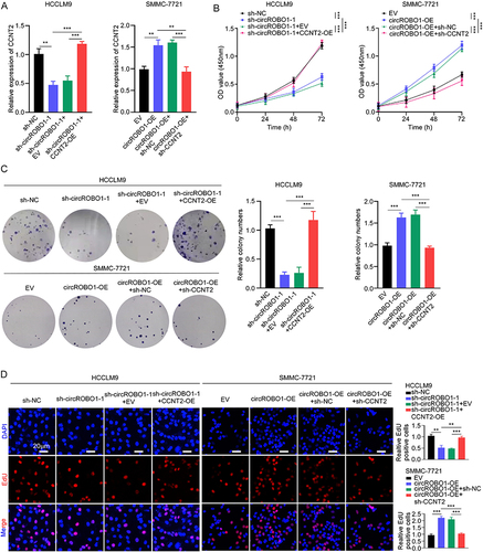 Figure 5 CircROBO1 promotes HCC proliferation by upregulating CCNT2 expression. (A) The relative expression of CCNT2 was detected in HCCLM9 and SMMC-7721 cells as indicated treatments. (B–D) The cell proliferative ability of HCCLM9 and SMMC-7721 cells as indicated treatments was detected by CCK8 (B), colony formation (C), and EdU (D) assays. Scale bar, 20 μm. Data were presented as means ±SD. **P<0.01; ***P<0.001.