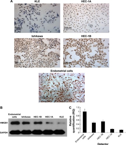 Figure 4 HMGB1 expressions in endometrial cancer cells and normal endometrial cells were assessed by ICC, Western blotting and RT-qPCR. HMGB1 expressions in endometrial cancer cell lines KLE, Ishikawa, HEC-1A, HEC-1B, and normal endometrial cell lines were measured by (A) ICC staining. (B) Western blotting. (C) RT-qPCR. The expression of HMGB1 was significantly strong in normal endometrial cells. Endometrial cancer cells such as KLE and HEC-1A, with the higher proliferation and invasion abilities, had lower expression of HMGB1, compared to Ishikawa and HEC-1B, which had the lower proliferation and invasion abilities (magnification 200×). *P<0.05.