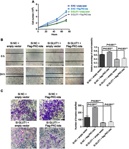 Figure 5 GLUT1 knockdown restrains PKC-iota-mediated growth of NSCLC cells. (A) After co-transfection with Flag-PKC-iota (or empty vector) and Si GLUT1 (or Si NC), the numbers of H1650 cells were counted at 24, 48, and 72 h. (B, C) H1650 cells were co-transfected with Flag-PKC-iota (or empty vector) and Si GLUT1 (or Si NC) for 36 h, after which time the cells were harvested to determine the migration and invasion capabilities by the wound-healing assay (left of (B) images of the indicated cells, scale bar: 25 μm; right of (B) statistical analysis of the migratory ability of the indicated cells) and transwell migration assay (left of (C) images of the indicated cells, scale bar: 25 μm; right of (C) statistical analysis of the invasive ability of the indicated cells), respectively.