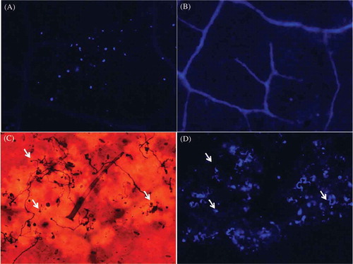 Fig. 3 (Colour online) Callose depositions in the interfaces between epidermal cells are related to the presence of the pathogen. (A) Callose depositions observed as blue fluorescence on a P. peruviana leaf at 48 hai. (B) Mock-inoculated P. peruviana leaf. (C) The presence of the pathogen (white arrows) was evident on inoculated P. peruviana leaves after staining with aniline blue and observed through bright field microscopy. (D) Callose depositions were observed in the interfaces between epidermal cells when observed under epifluorescent illumination. (C) and (D) correspond to the same field photographed under bright field or (D) fluorescence microscopy. Arrows indicate the presence of the pathogen. Strain 4084, originally isolated from P. peruviana, was used for (A) and strain 2400, originally isolated from potato, was used for (C) and (D).