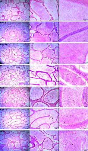 Figure 11 Light micrographs of the testes of normal and diabetic rats stained with hematoxylin–eosin (x400). The double arrows reveal sloughed germ cells within the epididymal lumen, while the red rectangle focuses on the cilia and brush border of the epithelium of the epididymis. (4x, 10x and 40x Magnification).