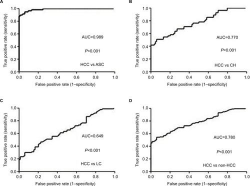 Figure 3 ROC curves of serum sTim-3 levels for discriminating HCC from ASC (A), CH (B), LC (C), and non-HCC (D).Abbreviations: ASC, chronic asymptomatic HBV carrier; HBV, hepatitis B virus; CH, chronic hepatitis; LC, liver cirrhosis; HCC, hepatocellular carcinoma; sTim-3, soluble T-cell immunoglobulin and mucin domain containing molecule-3; ROC, receiver operating characteristic; AUC, area under the ROC curve.