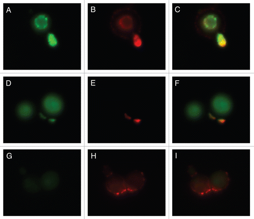 Figure 7 Colocalization studies of MP98 and other mannoproteins using mAb 18F2 and Con A lectin respectively. C. neoformans strain B3501 parts (A–F) and MP98 mutant strain parts (G–I). Left parts are C. neoformans treated with mAb 18F2 (green), middle parts Con A (red) and right parts are the merged images. In B3501 (parts A–F) Con A stains the mannoproteins of cell wall and mannoproteins found on the capsular edge, the mAb 18F2 specifically recognizes and binds to MP98. Parts (A–C) also show that MP98 is mostly localized next to the cell wall during budding. Parts (D–F) shows that 18F2 localizes to bud scars. Parts (G–I) shows that 18F2 is specific for MP98 but that other MPs are available to bind to Con A. Scale bar is 5 µm.
