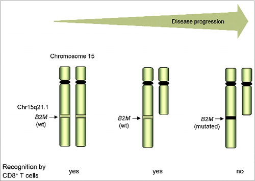 Figure 1. Genetic evolution of T-cell resistance in melanoma in the course of disease progression. The HLA class I-negative phenotype of T–cell-resistant melanoma cells is caused by the lack of B2M expression that, in turn, originates from an early-acquired deletion on chromosome 15q, including 1 B2M allele, followed by mutational inactivation of the remaining B2M gene. wt, wild type.