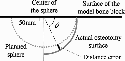 Figure 4. Evaluation of actual osteotomy surface.