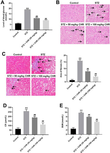 Figure 6 CHR significantly alleviated the symptom of DN in vivo. (A) The level of blood glucose in mice was tested. (B) H&E staining of mice kidney tissue in control, STZ, STZ + 50 mg/kg CHR or STZ + 100 mg/kg CHR group were detected. Black arrow indicates glomerular hypertrophy or inflammation infiltration. (C) Masson staining of mice kidney tissue in control, STZ, STZ + 50 mg/kg CHR or STZ + 100 mg/kg CHR group was detected. The rate of fibrosis in mice was quantified. Black arrow indicates collagen fibers. (D) The level of CR in serum of mice was measured by Creatinine Assay kit. (E) The level of BUN in serum of mice was measured by Urea Assay Kit. **P < 0.01 compared to control. ##P < 0.01 compared to STZ.