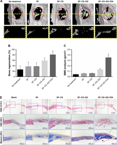 Figure 8 Micro-CT analysis of bone formation after the scaffold implantation into critical-sized bone defects 8 weeks later.Notes: (A) Micro-CT images of the bone regeneration from the different groups of the scaffolds. The yellow dotted line shows bone regeneration in bone defect in the sagittal plane. (B and C) Quantification of the bone formation from the micro-CT images (n=5, *P<0.05 as compared with other groups of scaffolds). (D) Histological analysis using H&E and Masson trichrome staining. The red dotted line represents the defect area (scale bar=2 mm), and the blue dotted line is one side of the defect under a high magnification view (40×; scale bar=500 µm).Abbreviations: CT, computed tomography; SF, silk fibroin; CS, chitosan; GO, graphene oxide.