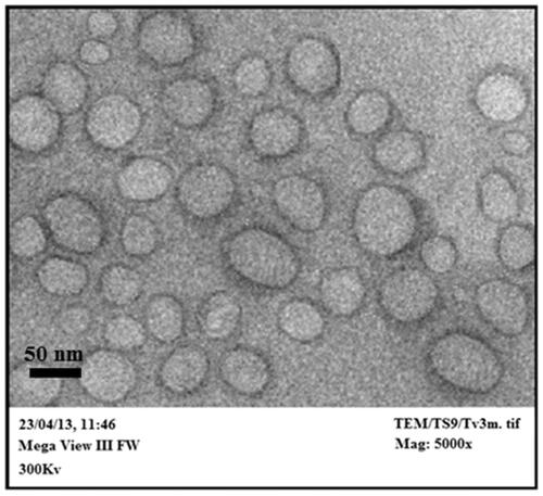 Figure 4. Transmission electron micrographs of optimized transfersomal formulation of paclitaxel (TS9).