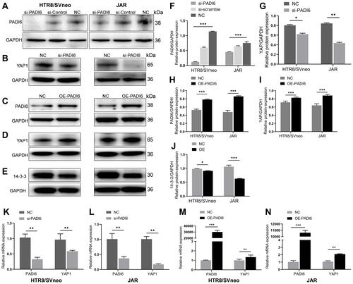 Figure 2 PADI6 expression was positively correlated with YAP1 expression. The transfection efficiency was determined by RT-PCR and Western blot. (A and B, F and G, K and L) Detection of si-PADI6 transfection efficiency in HTR-8/SVneo and JAR cells. PADI6 knockdown significantly inhibited the expression of YAP1. (C and D, H and I, M and N) PADI6 overexpression significantly increased the expression of YAP1. (E and J) PADI6 overexpression significantly decreased the expression of 14-3-3 proteins. *p < 0.05, **p < 0.01, ***p < 0.001 vs the control group.