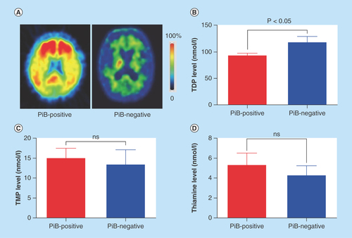 Figure 1.  Altered blood thiamine metabolites in Pittsburgh Compound-B-positive and -negative Alzheimer's disease patients clinically diagnosed.(A) The representative images of 11C-PiB PET in PiB-positive and -negative subjects are shown. (B) Blood TDP levels were significantly reduced in PiB-positive subjects (n = 33) as compared with that of PiB-negative subjects (n = 5) (p < 0.05). (C & D) The levels of blood TMP and thiamine were not significantly different between PiB-positive subjects and PiB-negative subjects (both p > 0.05).PiB: Pittsburgh Compound-B; TDP:Thiamine diphosphate; TMP: Thiamine monophosphate.