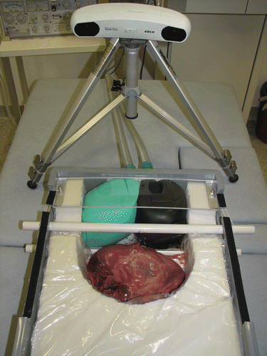 Figure 4. Experimental setup in the computed tomography (CT) room, showing the optical tracking system and respiratory liver motion simulator (without skin) in end-inspiration with a mounted porcine liver. [Color version available online.]