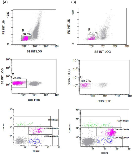 Figure 1 Representative dot plots showing gating of lymphocytes using forward scatter/ side scatter characteristics (FSC/SSC), gating of (CD3-) population, and different natural killer (NK) cell subsets. Dot plots showing: (A) a case of DVT, and (B) a sample of healthy control group.