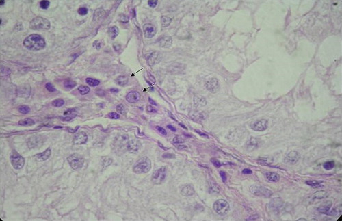 Figure 6. Photomicrograph of the testis in a four-month-old male kid showing Leydig cells (arrows) in the intertubular tissue. H & E, 1000X.