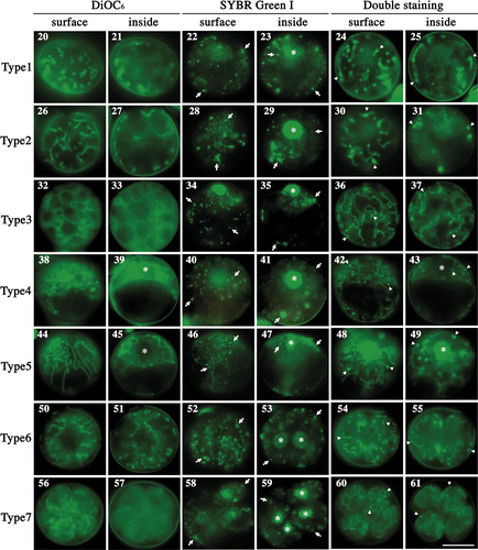 Figs 20–61. Fluorescence micrographs of mature zygotes after light exposure. Fluorescence micrographs of zygotes stained with DiOC6 (Figs 20, 21, 26, 27, 32, 33, 38, 39, 44, 45, 50, 51, 56, 57), SYBR Green I (Figs 22, 23, 28, 29, 34, 35, 40, 41, 46, 47, 52, 53, 58, 59), and both SYBR Green I and DiOC6 simultaneously (Figs 24, 25, 30, 31, 36, 37, 42, 43, 48, 49, 54, 55, 60, 61). Figs 20, 22, 24, 26, 28, 30, 32, 34, 36, 38, 40, 42, 44, 46, 48, 50, 52, 54, 56, 58, 60. Images focused on the surface layer of a single zygote. Figs 21, 23, 25, 27, 29, 31, 33, 35, 37, 39, 41, 43, 45, 47, 49, 51, 53, 55, 57, 59, 61. Images focused on the inside of a single zygote. The images were taken approximately 0 h (Figs 20–25), 3 h (Figs 26–31), 7 h (Figs 32–37), 11 h (Figs 38–43), 14 h (Figs 44–49), 16 h (Figs 50–55) and 20 h (Figs 56–61) after light exposure. Asterisk: cell nucleus. Arrow: organellar nucleoid. Arrowhead: mitochondrial nucleoid. Scale bar: 5 µm.