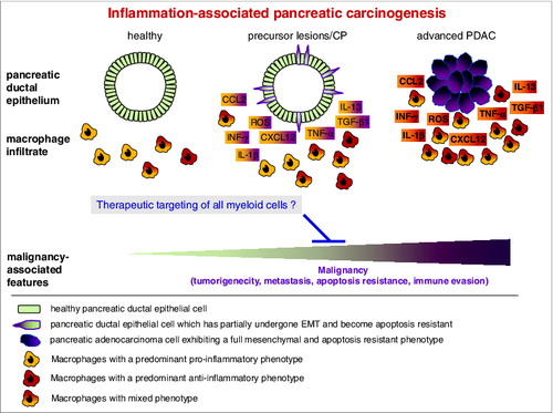 Figure 1. Macrophages with pro- and anti-inflammatory properties contribute to pancreatic tumorigenesis. In the course of inflammation-associated initiation and progression of pancreatic ductal adenocarcinoma, macrophages exhibiting distinct characteristics accumulate in pancreatic tissues, some of which are localized in close proximity to the cancerous epithelium. Upon this mutual interaction, a plethora of pro- and anti-inflammatory cytokines (e.g., IFN-γ, IL-1β, IL-13, TNF-α, TGF-β1), chemokines (CCL2, CXCL12) and reactive oxygen species (ROS) are released by carcinoma cells as well as by the heterogenic population of macrophages. In chronic pancreatitis or pancreatic ductal adenocarcinoma (PDAC), these factors account for the acquisition of malignancy-associated alterations in the conversion of pancreatic epithelial to carcinoma cells, on the one hand, while reciprocally contributing to the shaping of the phenotype and function of the macrophages on the other hand. Accordingly, therapeutic strategies targeting all myeloid cells might represent effective weapons to comprehensively impair tumorigenicity, metastasis, apoptosis resistance and immune evasion in PDAC patients.