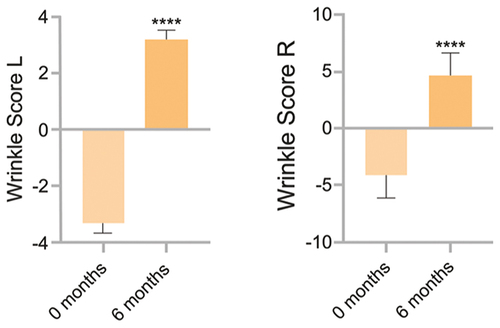 Figure 3 Treatment outcome assessed with wrinkle score scale. ****p < 0.0001.