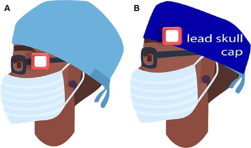 Figure 1 DoseAware dosimeter placement on the left temple external to lead glasses (A) and skull cap (B).