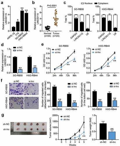 Figure 2. Interference with LINC00115 inhibits the development of RB in vivo and in vitro. (a) qRT-PCR analysis of the expression of LINC00115 in ARPE-19, Y79, SO-RB50, HXO-RB44. *P < 0.05, **P < 0.001, vs. ARPE-19. (b) qRT-PCR was used to detect the expression of LINC00115 in RB tissues (N = 24) and normal tissues (N = 24). (c) Nuclear and cytoplasmic separation to detect the expression of LINC00115 in SO-RB50, HXO-RB44 cytoplasm and nucleus. (d) qRT-PCR was used to detect the expression of LINC00115 in SO-RB50, HXO-RB44 transfected control si-NC or si-lnc. (e) CCK-8 detecting the cell viability of the transfected control si-NC or si-lnc in SO-RB50 and HXO-RB44. (f) Transwell assays detectingcell migration in SO-RB50 and HXO-RB44 transfected with control si-NC or si-lnc. **P < 0.001, vs. si-NC. (g) Representative images of tumors in nude mice 4 weeks after injection of si-NC or si-lnc SO-RB50 cells. **P < 0.001, vs. sh-NC. Data are presented as mean ± SD. N = 3, repetition = 3.