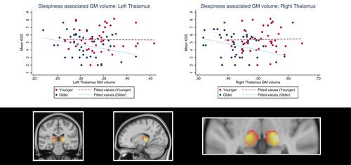 Figure 2 Demonstration of sleepiness (KSS scores)-associated thalamic gray matter volume in younger and older adults. The plots show the age interaction effect suggesting that sleepiness is negatively associated with left and right thalamus gray matter volume in older adults, but positively associated in younger individuals. The colors in the brain plot represent statistical t-values ranging from 0 (black) to 5.0 (white).Abbreviation: KSS, Karolinska Sleepiness Scale.