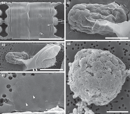 Figs 44–48. Mitotically dividing cells, oocytes, eggs and spherical cells, scanning electron microscopy. Fig. 44. A fully extended frustule, possibly following mitosis, demonstrating the structure of cingula in a vegetative frustule. Fig. 45. An oogonial theca with a secondary oocyte (or an egg) showing copulae similar to those in a vegetative frustule (arrowheads). Fig. 46. A close-up of the distal part of the oogonial cingulum in Fig. 45 showing the structure of copulae (arrowheads) different from those located closer to the valvocopula indicated in Fig. 45. Fig. 47. A close up of specimen from Fig. 45 showing no incunabular scales. Fig. 48. A spherical cell, possibly a small egg, showing the very delicate cell membrane (preserved on smooth surface of the bottom part of the cell) with no siliceous structure in evidence. Scale bars: Fig. 44, 50 µm; Fig. 45, 25 µm; Fig. 46, 5 µm; Figs 47, 48, 10 µm.