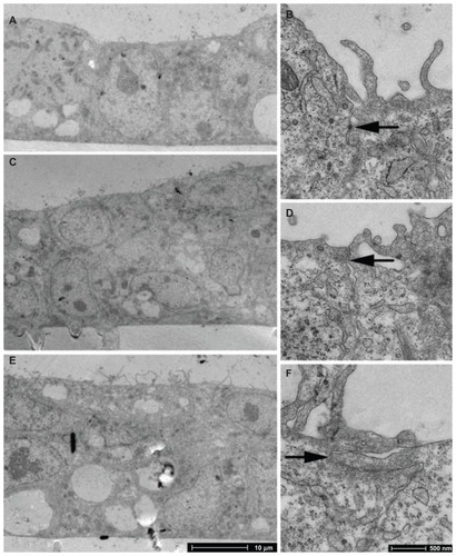 Figure 4 TEM imaging of BeWo cells grown on PC membranes with 3 μm pore size. (A and B) day 3 PS; (C and D) day 4 PS; (E and F) day 5 PS.Notes: Arrows indicate tight junctions. There is evidence of monolayer formation at day 3 PS and overgrowth by day 5 PS.Abbreviations: PS, post-seeding; TEM, transmission electron microscopy.