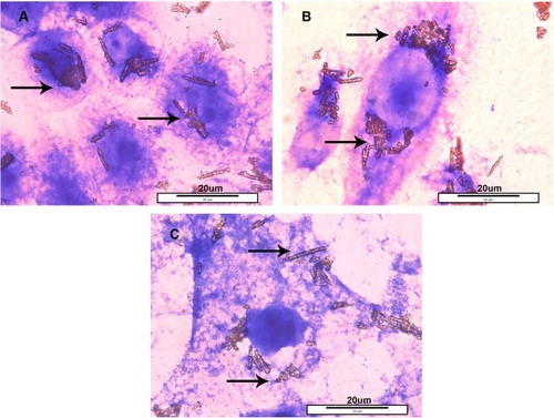 Figure 3 Localisation of BiONPs near the nuclei inside the (A) MCF-7, (B) MDA-MB-231 and (C) NIH/3T3 cells, after 24 hrs of incubation with 0.5 mMol/L of the BiONPs.Notes: Arrows indicated the rod-shaped BiONPs. The scale of each picture is 20 µm.Abbreviation: BiONPs, bismuth oxide nanoparticles.