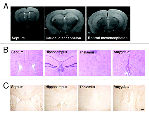 Figure 6. MRI and histological analysis of AAV9-scFvD18 treated mice. T2-weighted MRI images (A) of animals of the groups (i) and (ii) were monthly acquired and confirmed that neither the inoculation of the vector nor the viral particles themselves had neurotoxic effects. H&E stain (B) of septum, hippocampus, thalamus and amygdala shows normal appearance of these structures, and GFAP immunostain (C) of the same areas rules out astrocytic activation related to the injection. Scale bar = 25 μm (all microphotographs are at the same magnification).