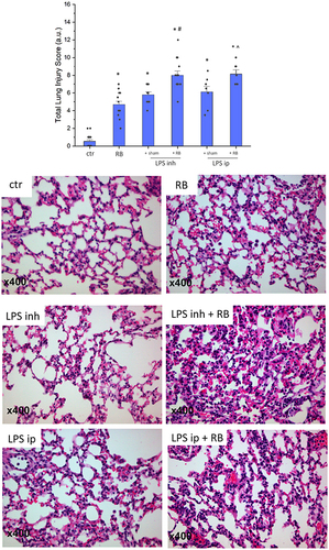 Figure 5 Histological evidence of lung injury following resistive breathing and endotoxin exposure. Upper: Combining resistive breathing with LPS exposure, either inhaled or intraperitoneal, resulted in a significant augmentation of histological lung injury, compared to each exposure alone. Lower: Representative figures of H&E-stained lung tissue sections (x400 magnification) from all experimental groups. Please note the significant augmentation of lung injury when RB was combined to LPS inhalation (mainly due to increased interstitial and intra-alveolar leukocyte infiltration) and to LPS ip exposure (mainly due to increased interstitial leukocyte infiltration and capillary congestion). Data presented as mean ± sem with overlapped data points, n=7–15 per group, *p<0.05 to ctr, #p<0.05 to LPS inh, ^p<0.05 to LPS ip.