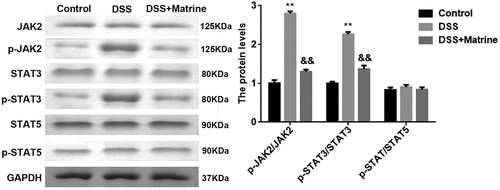 Figure 4. Effect of matrine on JAK2/STAT3 pathway. The JAK2, p-JAK2, STAT3, p-STAT3, STAT5, and p-STAT5 expression was tested using Western blot. **P < 0.01 vs. the control group. &&P < 0.01 vs. the DSS group.