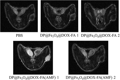 Figure 7 MRI imaging of tumors with DP@Fe3O4@DOX-FA with or without the AMF.