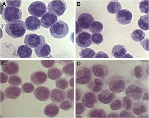 Figure 5 Realgar NPs induced cell differentiation.Notes: K562 cells were treated with realgar NPs 0 μg/mL (A and C) or 5 μg/mL (B and D) for 48 h. (A) and (B) were tested by using Wright–Giemsa staining, and (C) and (D) were tested by H&E staining.Abbreviations: H&E, hematoxylin–eosin; NP, nanoparticle.