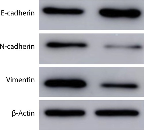 Figure 6 Western blot of N-cadherin, vimentin, E-cadherin, and β-actin.Notes: After transfecting with negative control or si-Linc01194, protein of HCT116 cells were extracted for Western blot analysis.