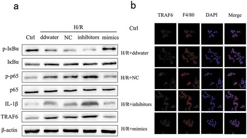 Figure 3. Effects of miR-125b on p-p65 nuclear translocation and pro-inflammatory cytokines.(a) The nuclear translocation of p-p65 in cells was measured. F4/80 was used as the molecular marker of RAW 264.7 cells. The original magnification = 400×. (b-d) Cell supernate levels of TNF-α, IL-1β and IL-6 were measured. aP < 0.05 compared with Ctrl groups. cP < 0.05 compared with NC groups.