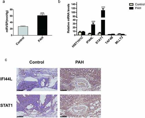 Figure 6. Validation of the key genes in a rat PAH model (a) Mean right ventricular systolic pressure (mRVSP) in control and MCT-induced PAH rats. (b) The levels of HIST1H1C, IFI44L, STAT1, TAF4B, and MLLT3 mRNA expression in lung tissues from control and MCT-induced PAH rats; (c) The expression of IFI44L and STAT1 in the lung tissue of the control group and PAH group. Representative immunostaining images of lung sections show the expression of IFI44L and STAT1 increased in the lung tissues of MCT-induced PAH rats. Scales bars, 50 μm for high-resolution images (original magnificationⅹ400). N = 6 for the control group and PAH group. Compared with the control group, ***P < 0.001. Data presented in A and B are mean ± SEM of three independent experiments. PAH, pulmonary arterial hypertension