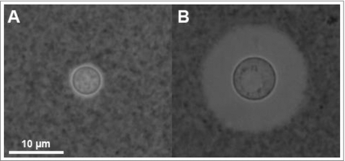 Figure 1. Cryptococcus neoformans yeast cells visualized by India Ink under phase contrast microscopy. India Ink particles are excluded from the dense PS capsule. A. Yeast cells cultured in an environment with optimal nutrition. B. Yeast cells cultured within mouse bone-marrow derived macrophages, experiencing starvation and oxidative stress from the phagolysosome for 24 h. Note the increased cell body, generation of what appears to be a large vacuole, and drastic increase in capsule size. Both images were obtained at 100x magnification with 2 × 2 binning.