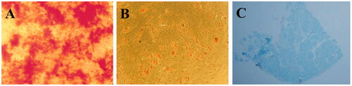 Figure 1. Alizarin-red staining of isolated stem cells cultured under osteogenic induction medium after two weeks (A); Oil-Red staining of isolated stem cells cultured under adipogenic induction medium after two weeks (B); Alcian blue staining of isolated stem cells cultured under chondrogenic induction media after two weeks (C).