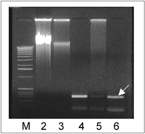 Figure 1.  Multiple displacement amplification (MDA) products of Salmonella enteritidis LK5. Whole genomic DNA was amplified from approximately 600 (lane 2) and 60 (lane 3) colony-forming units (cfus) after releasing genomic DNA by heating at 98°C for 10 min. S. enteritidis-specific fragments (294 bp) were amplified from the respective MDA products (lanes 4 and 5). Purified S. enteritidis LK5 genomic DNA was used as positive control to amplify sdf I fragment indicated by the arrow (lane 6). A 1-kb DNA ladder (Invitrogen, Carlsbad, CA, USA) was used as a standard marker (M).