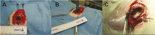 Figure 2. The cavity created for accommodating the CITT probe prior to placement of the device (A), after placing the CITT device (B) and at the end of the CITT ablation (C).