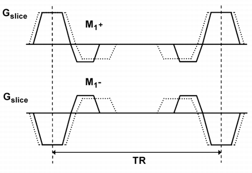 Figure 1. Slice selection gradients applied in the PC‐SSPC sequence. The first order moments (M1+, M1−) are changed to create different velocity sensitivities. The slice‐select gradient is inverted in the second scan segment (M1−).