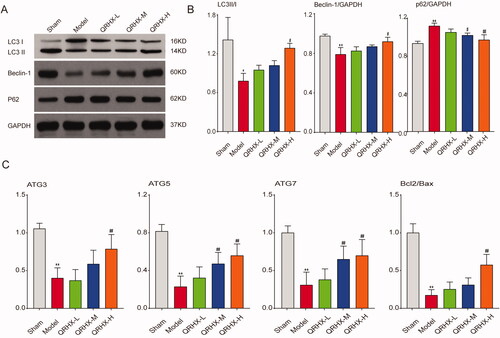 Figure 8. QRHX activated autophagy to exert myocardial protective function. (A) Protein expression levels of LC3B, Beclin-1, p62. (B) Quantitative analysis of LC3B, Beclin-1, p62 using ImageJ software. (C) mRNA expression levels of ATG3, ATG5, ATG7, Bcl2/Bax. Data were expressed as mean ± SEM. **p < 0.01 vs. Normal group, #p < 0.05 and ##p < 0.01 vs. Model group.