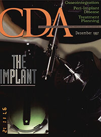 Cover image for Journal of the California Dental Association, Volume 25, Issue 12, 1997