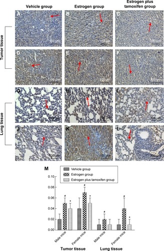 Figure 9 Protein immunohistochemical results of AKT in mice tumor tissue and lung tissue; 400× magnification.