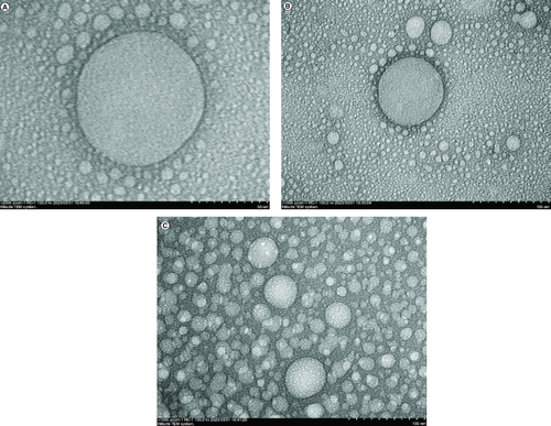 Figure 1. Transmission electron microscopy of GDEN with magnification.200.000× (A), 100.000× (B) and (C).