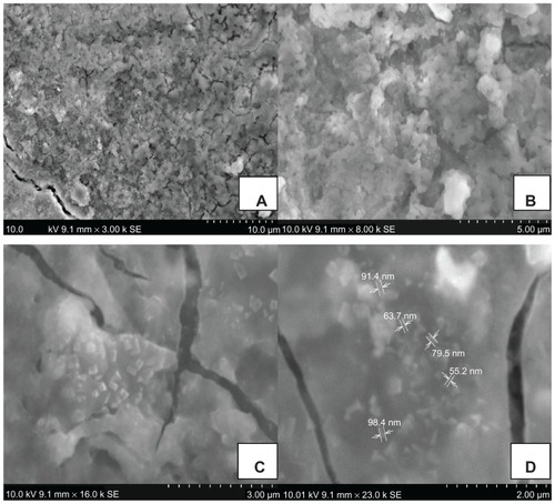 Figure 3 Scanning electron microscopic images of phytochemically synthesized gold nanoparticles. (A) and (B) Formation of gold nanoparticles by reduction of gold ions. (C) Different shapes of particles formed (16,000×) and (D) nanometer size of gold nanoparticles (23,000×).